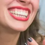 Навіщо жувати гвоздику натще: стоматологи здивували порадою, яка позбавить карієсу…