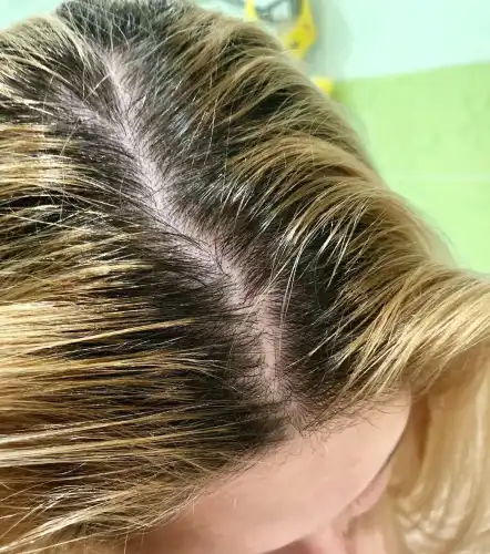 2 помилкові та 3 слушні рекомендації для тих, чиє волосся&hellip;