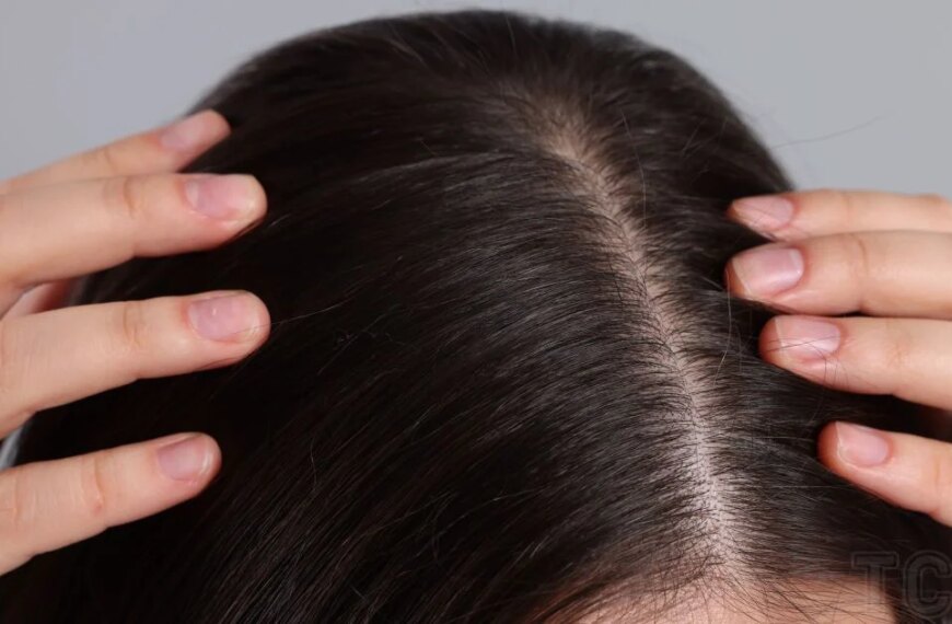 Чому шкіра голови свербить — 12 причин, що вимагають уваги