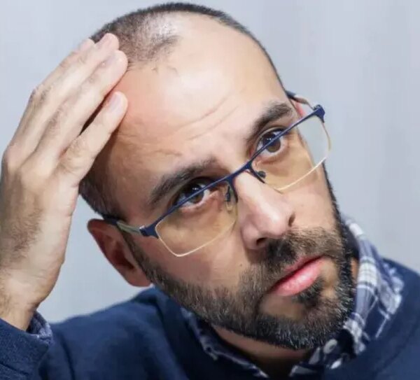 Успішні випробування таблетованого міноксидилу проти облисіння