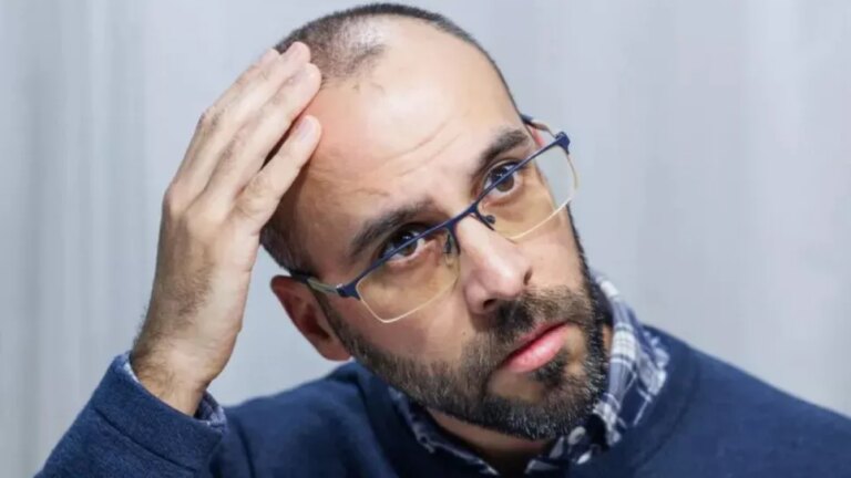 Успішні випробування таблетованого міноксидилу проти облисіння 2