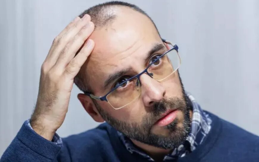 Успішні випробування таблетованого міноксидилу проти облисіння