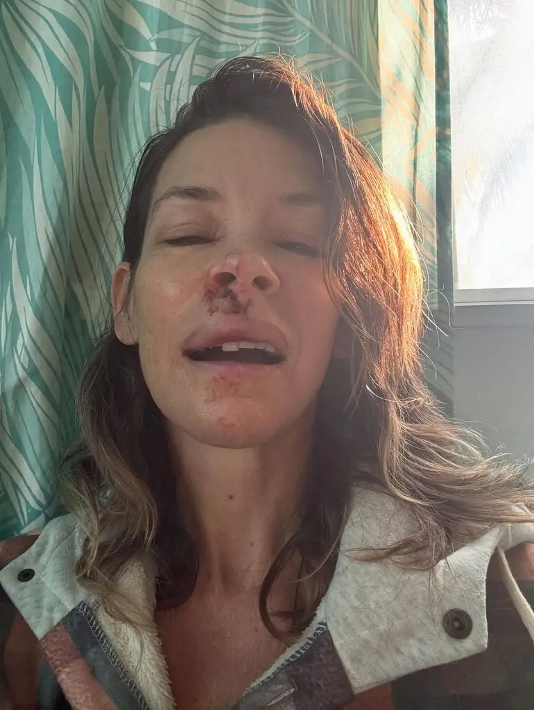 What happened to Lost star Evangeline Lilly? Inside her quiet new life after stepping back from Hollywood3